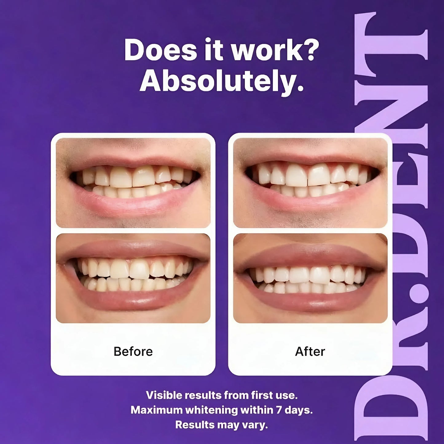 DR.DENT™ Purple Teeth Whitening Strips