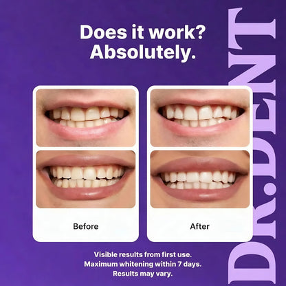 DR.DENT™ Purple Teeth Whitening Strips